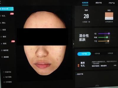 皮膚檢測(cè)儀哪家強(qiáng)?Visia、美圖宜膚、A-one實(shí)測(cè)