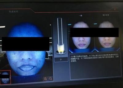 皮膚檢測(cè)儀深度實(shí)測(cè) Visia、美圖宜膚、A-one究竟哪家強(qiáng)？